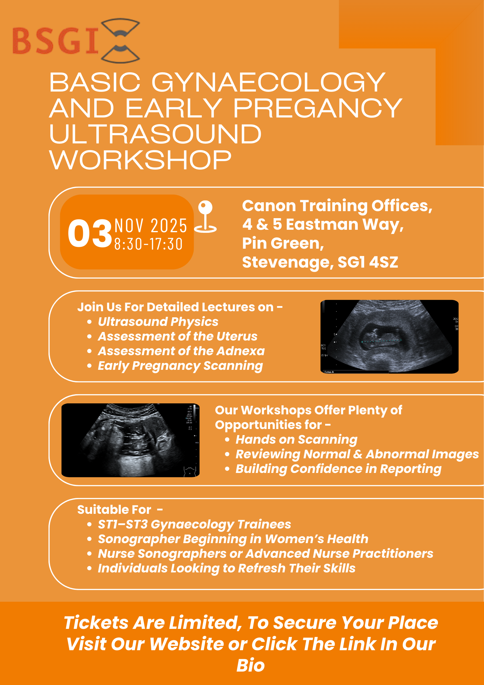 Poster advertising a basic gynaecology and early pregnancy ultrasound workshop, featuring event details and scan images.